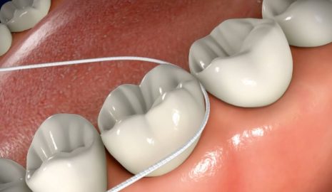 The Importance of Proper Flossing Techniques