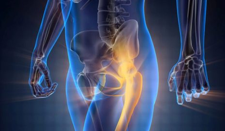 The Importance of Boron for Bone Density