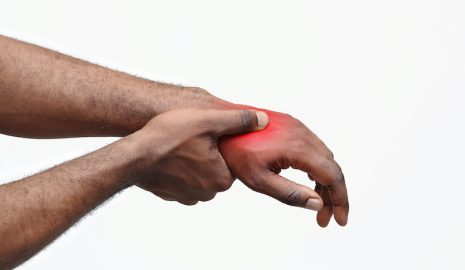 Carpal Tunnel Syndrome: What Men Need to Know