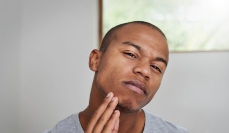 How to Manage Hyperpigmentation and Skin Discoloration in Men