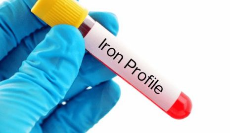 The Importance of Iron Tests