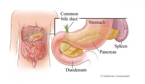 The Importance of Regular Pancreatic Cancer Screenings