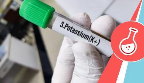 The Importance of Potassium Tests