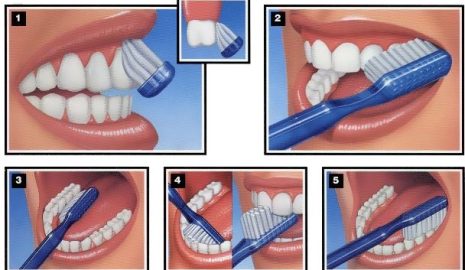 The Importance of Proper Brushing Techniques