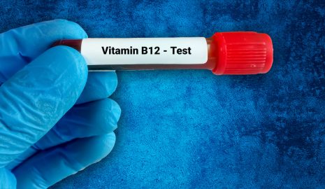 The Importance of Vitamin B12 Tests